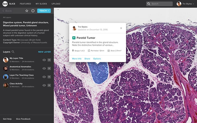 The Slice web application showing a selected user annotation.